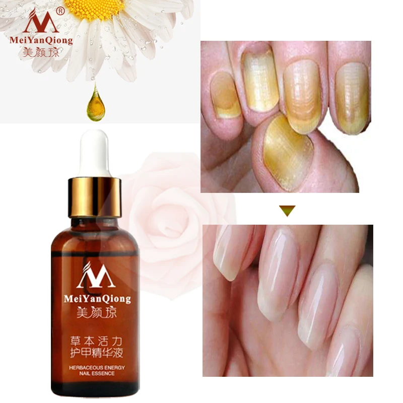 

Hand Care Nail Treatment Essence Nail Foot Whitening Toe Nail Fungus Removal Serum