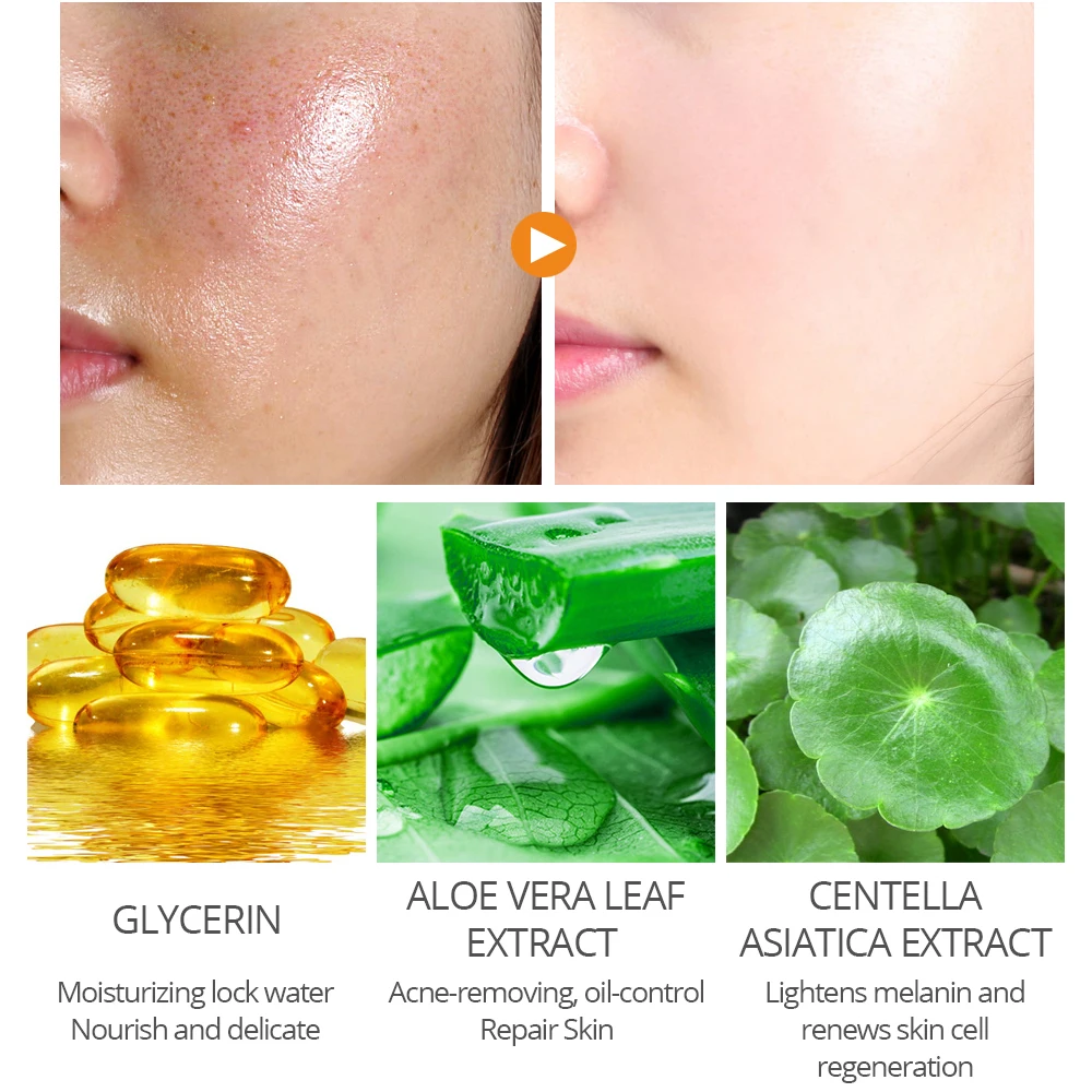 

VIBRANT GLAMOUR Salicylic Acid Perfecting Gel Face Mask Face Cream Shrink Pores Control-oil Removing Acne Moisturizing Skin Care