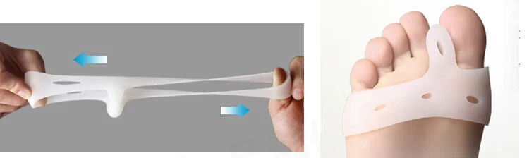 2 шт. корректор большого пальца ноги при вальгусной деформации |