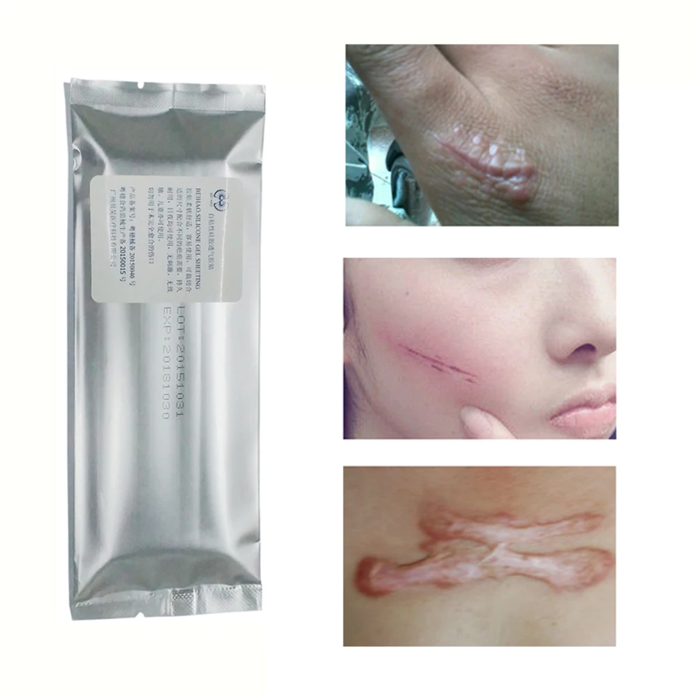 Силиконовый пластырь для удаления рубцов 1 шт.|Устройство ухода за кожей лица| |