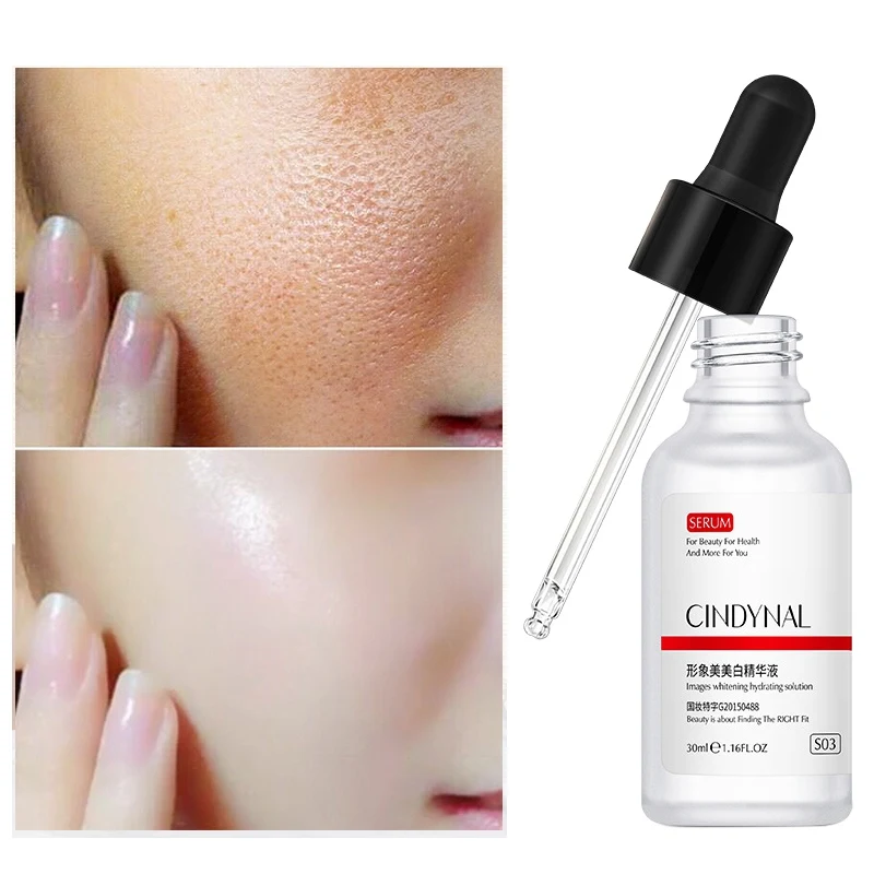 Отбеливающая Сыворотка для лица Увлажняющий Осветляющий пигмент осветления