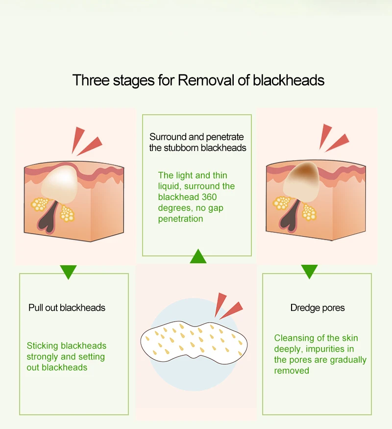 ROSALIND Face Masks Set Face Serum Facial From Black Dots Remove Deep Cleaning Blackhead Nose Strip Peeling Shrinking Nose Pores