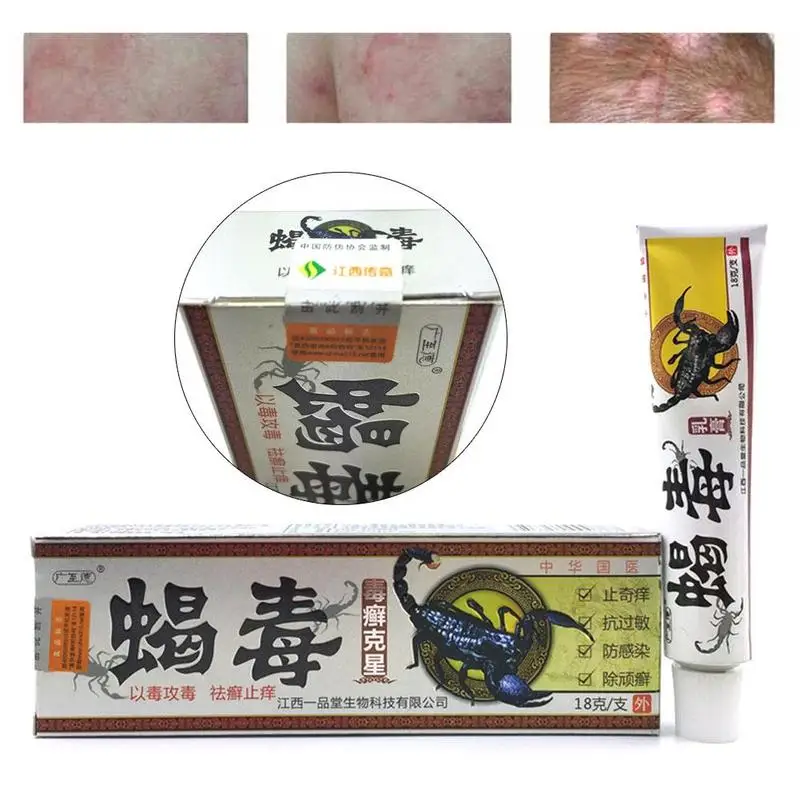 

Dropshipping 1Pc Scorpion Poison Tinea Antibacterial Cream Ointment Skin Care Dermatitis Eczema Pruritus Psoriasis Ointment