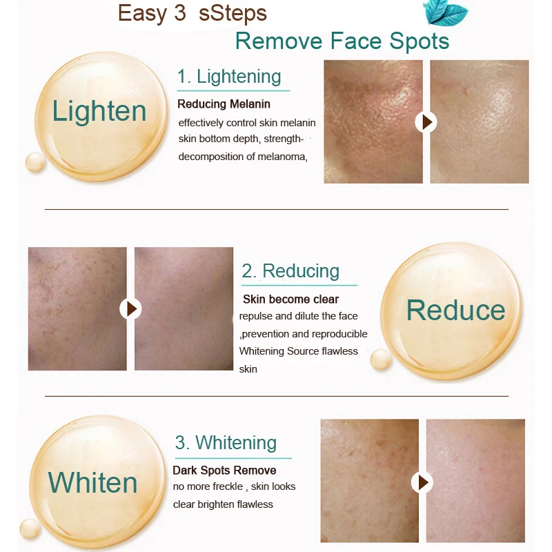 Крем для отбеливания лица с травяной формулой 50 г эффективный крем удаления