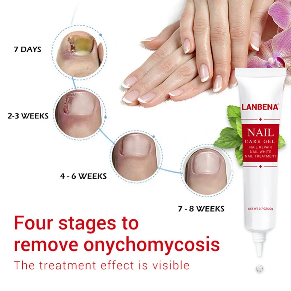 Гель LANBENA для ухода за ногтями лечение грибковых ногтей Удаление онихомикоза