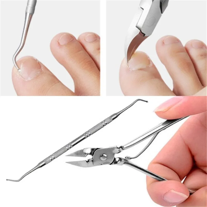 2 шт./компл. средство для удаления грязи из омертвевшей кожи педикюр уход за