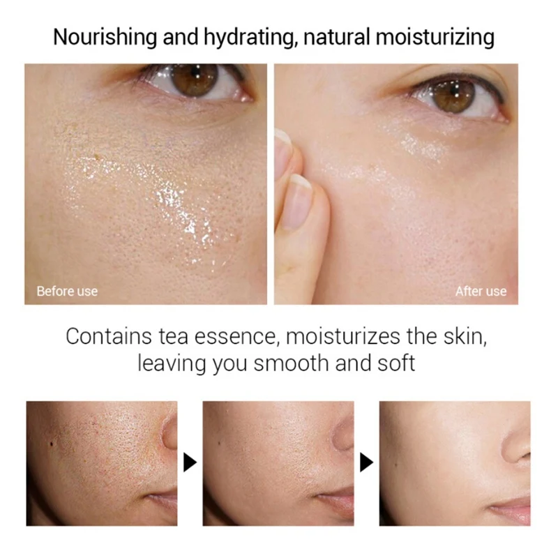 Сывороточная эссенция восстановление и Отбеливание лица с зеленым чаем