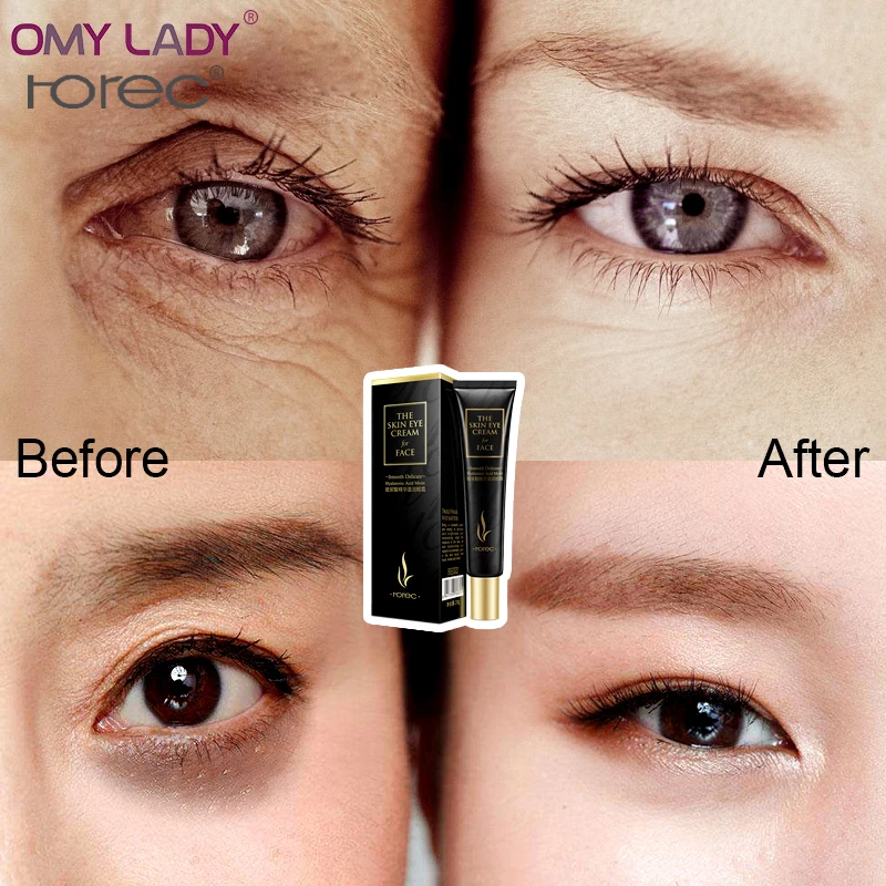 Набор для ухода за кожей лица ROREC гиалуроновая кислотная эссенция сыворотка крем