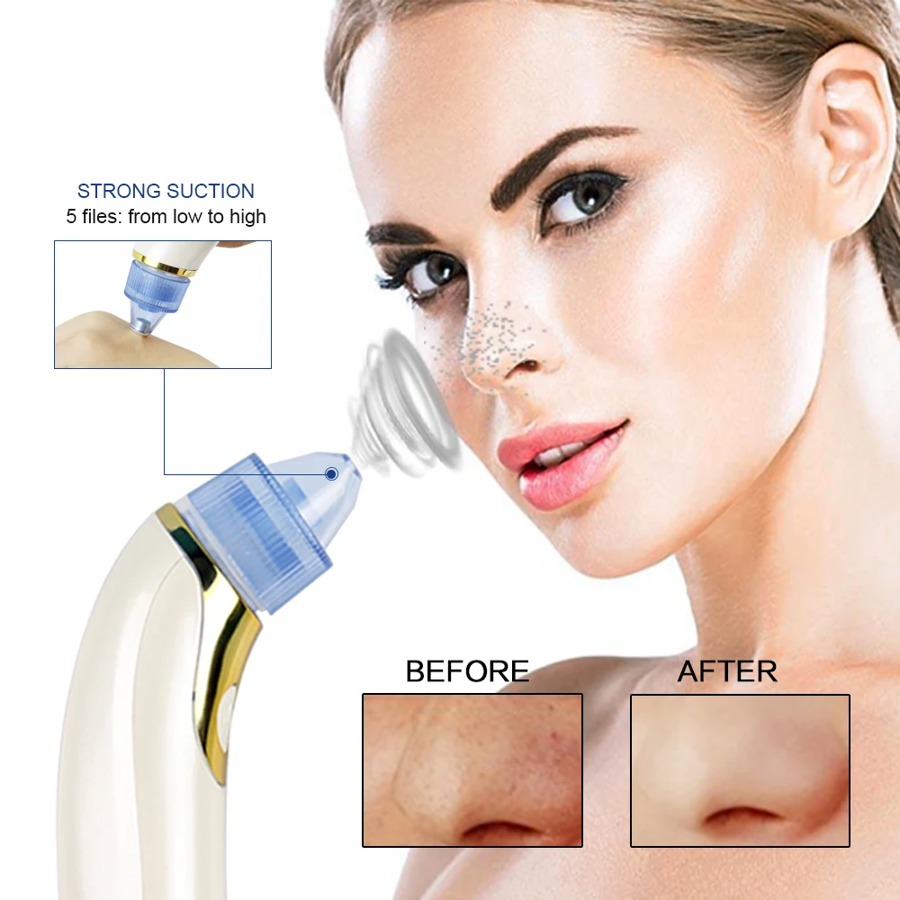 Дома применение уход за кожей угрей для глубокой очистки кожных пор Acne Удаление