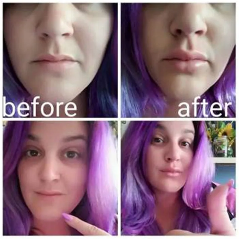 Визуальный источник насос для губ Силиконовое сексуальное устройство усиления в