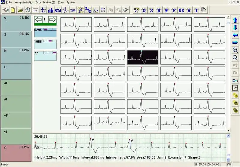 Динамические системы ЭКГ TLC6000 динамические 12 свинцовых систем Holter 48 часов записи