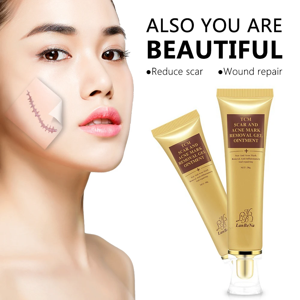 3 шт. мазь от угрей для удаления шрамов и пуль|Устройство ухода за кожей лица| |