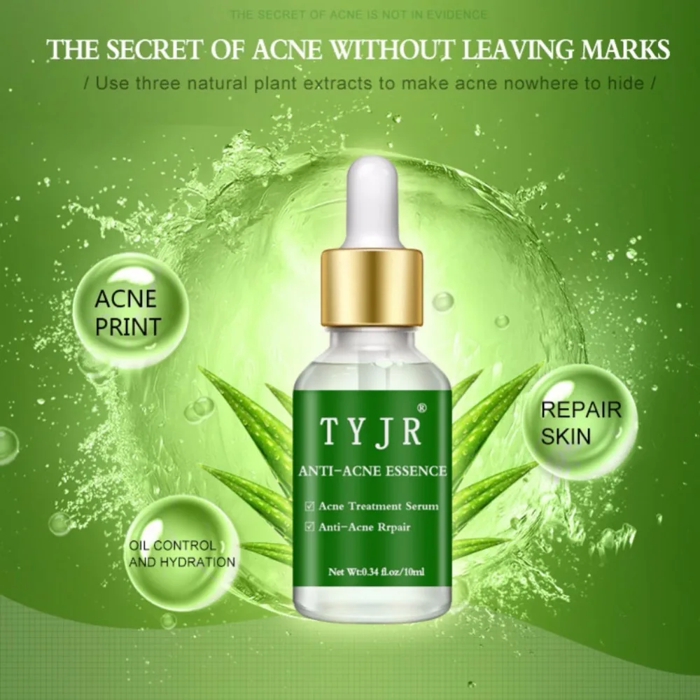 

Aloe Vera Acne Removal Essence Moisturizing Oil-Control Anti-Inflammatory Acne Repair Skin Pimples Treatment Essence