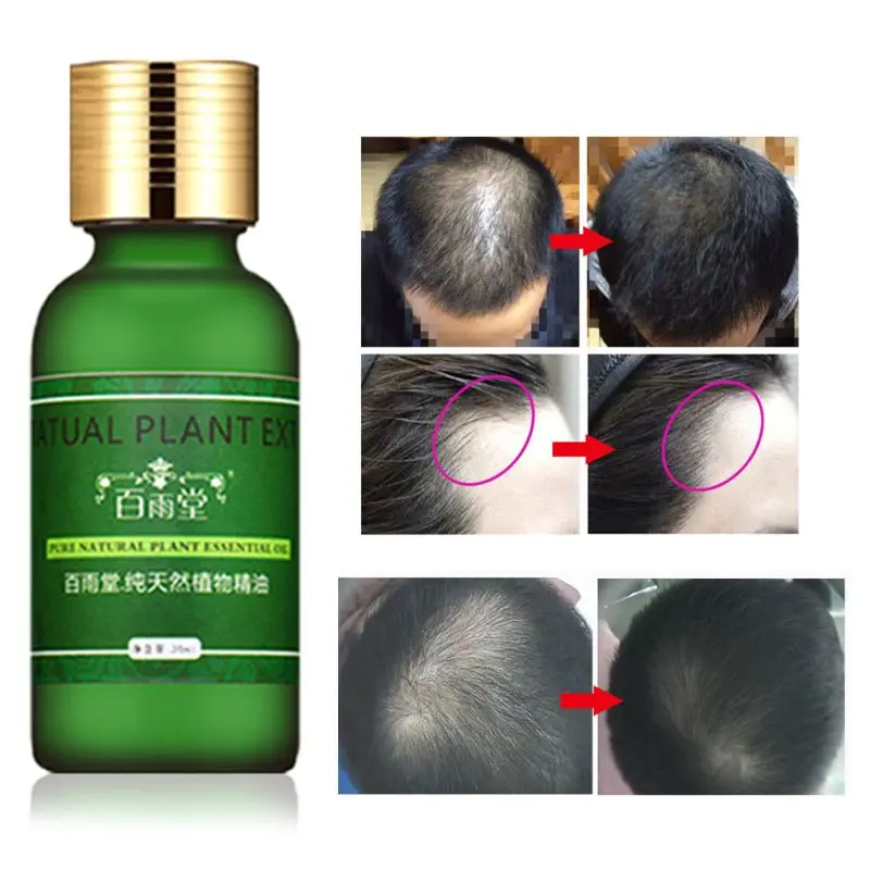 30ml Hair Care Growth Essential Oils Essence Original Authentic 100% Loss Liquid Health Beauty Dense | Красота и здоровье