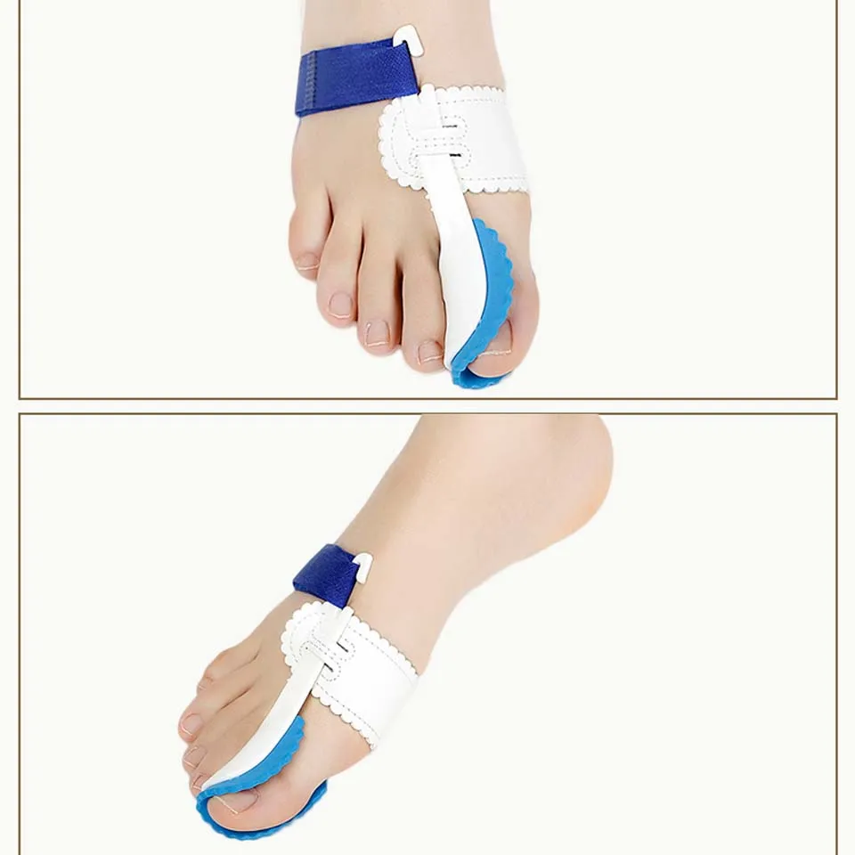 Коричневые ортопедические скобы для пальца ноги 2 шт.|goodnight bunion|correction foothallux valgus |