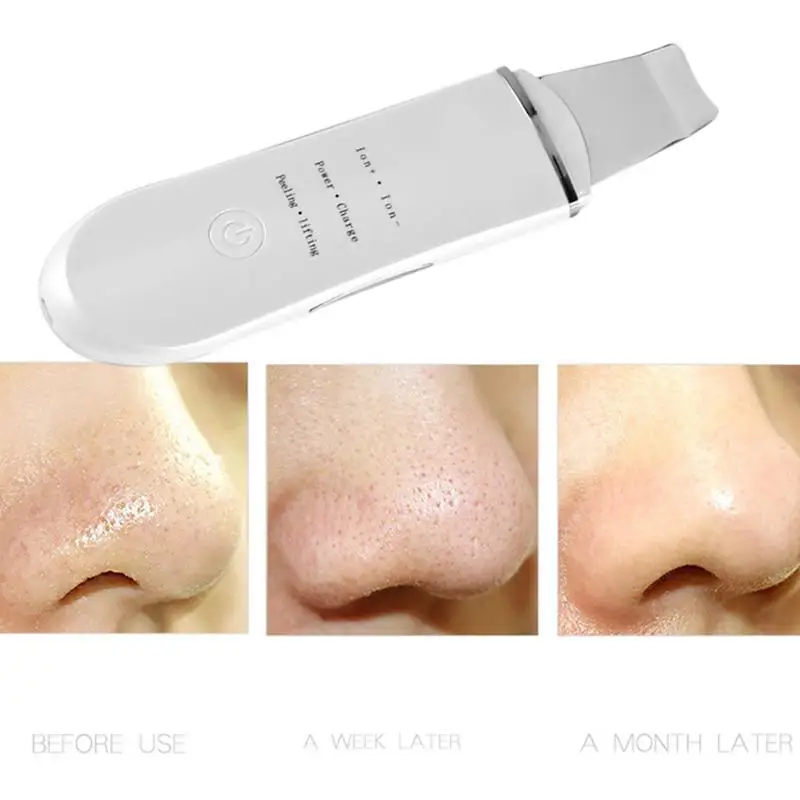 RF Ультразвуковой скребок для кожи лица Красота Массажер очиститель пор удалить