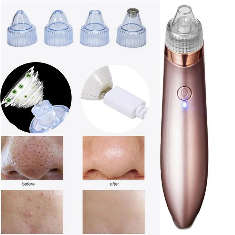 Средство для удаления акне точка Noir Blackhead вакуумный экстрактор инструмент черные