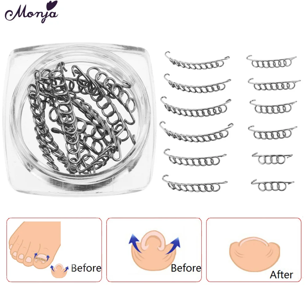 Моня 12 шт. коррекция вросший носок фиксатор для ногтя педикюра пароникья