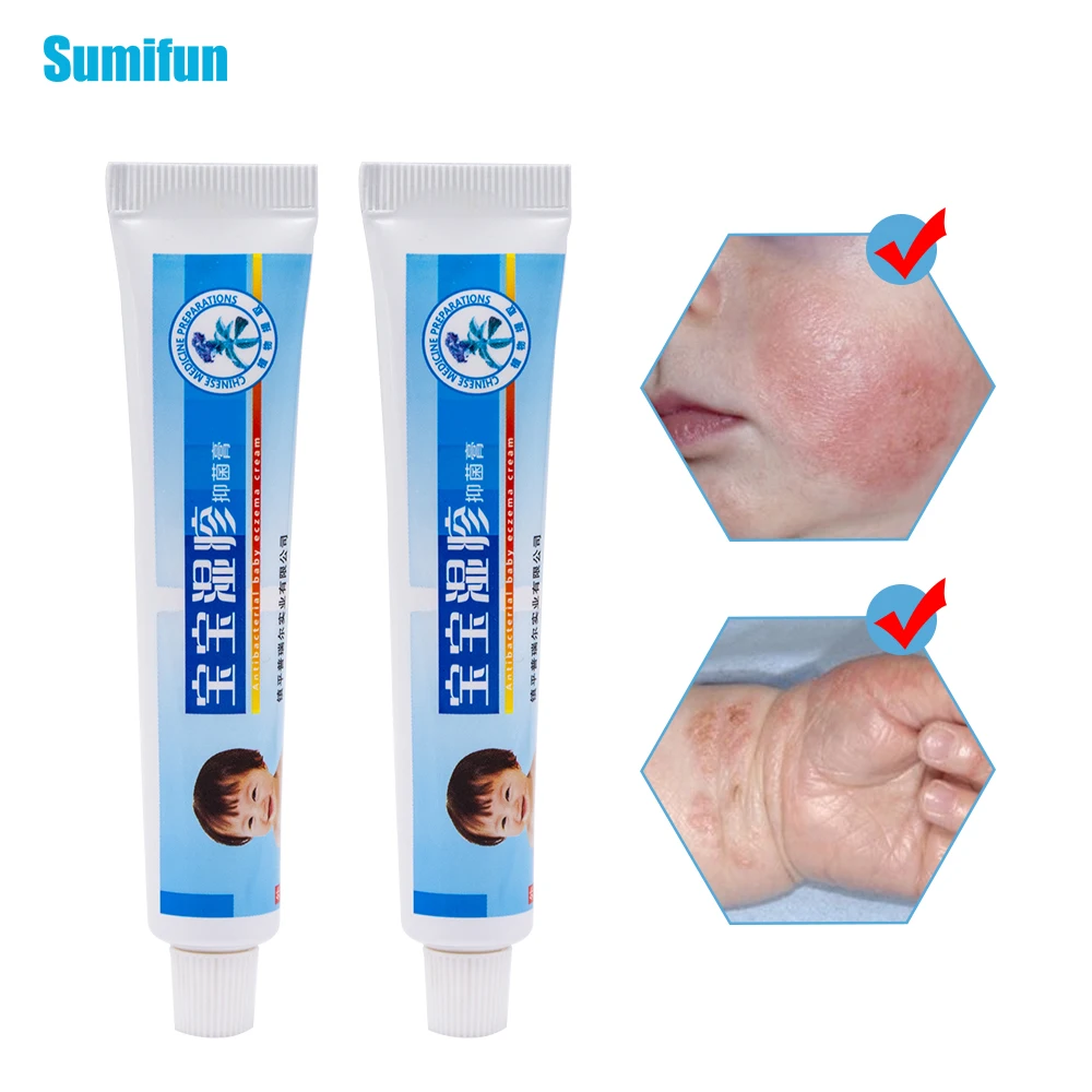 1 шт. детский Eczema крем от псориаза Pruritus дерматит зуд ремонт кожи Китайский