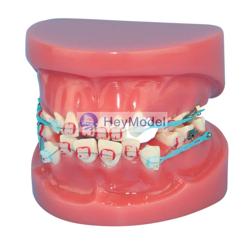 

HeyModel Fixed Orthodontic model All ceramic bracket tooth model Dentistry teaching