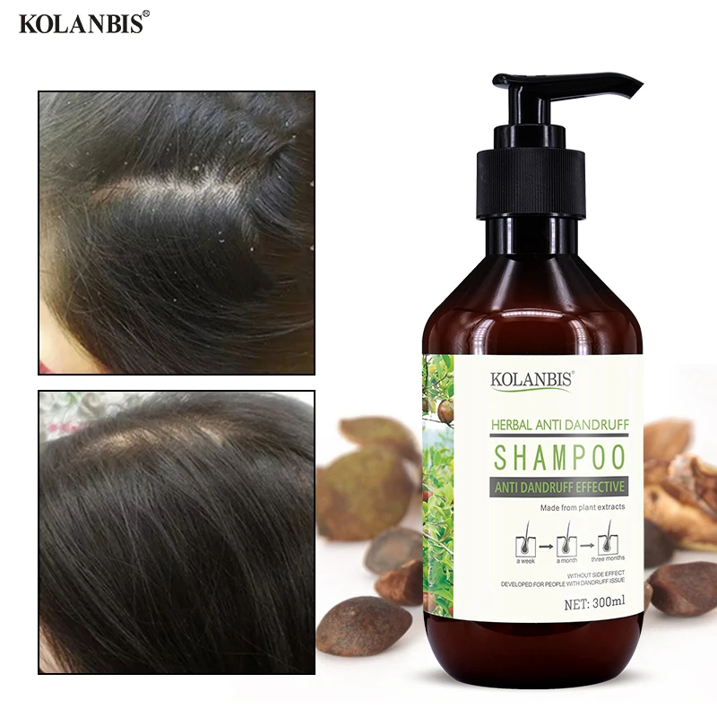 

Hair Anti Dandruff Shampoo Scalp Care Nutrition Nourish Tea Tree Oil Product Oily Control Treatment Hair Refreshing Anti Itchy