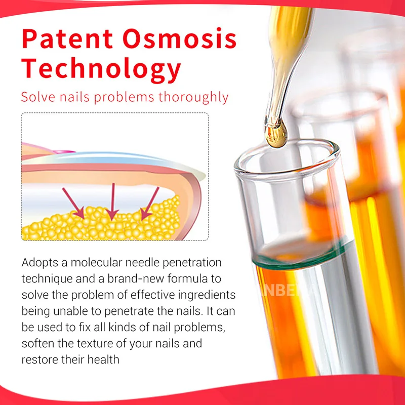 Ремонт ногтей гель грибковое Лечение Удаление онихомикоза ног Питательный Уход