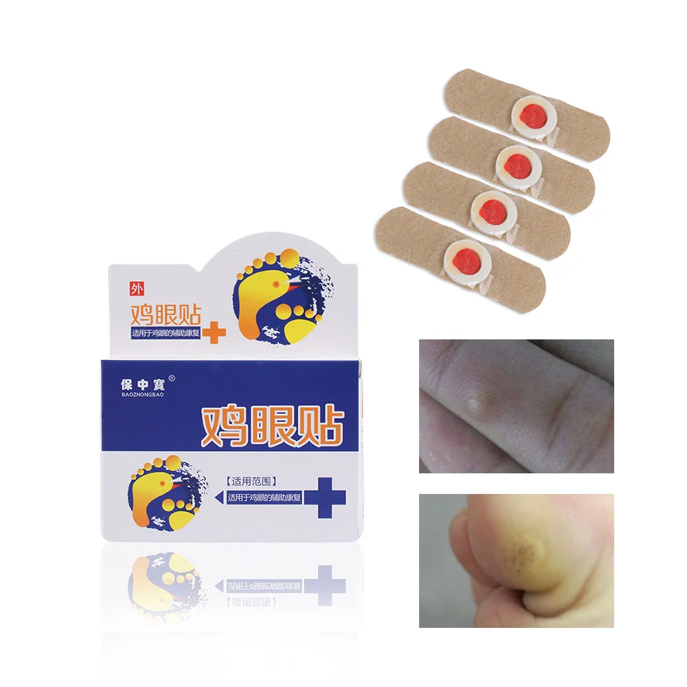 6 шт. средство для удаления мозолей ног Plantar Warts Anti germ Thorn обезболивающий пластырь