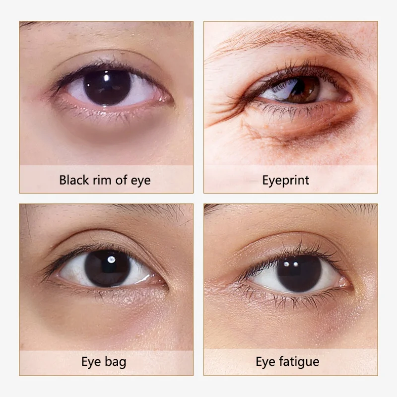 Отбеливающая 24 каратная Золотая маска с улиточным коллагеном для глаз удаление