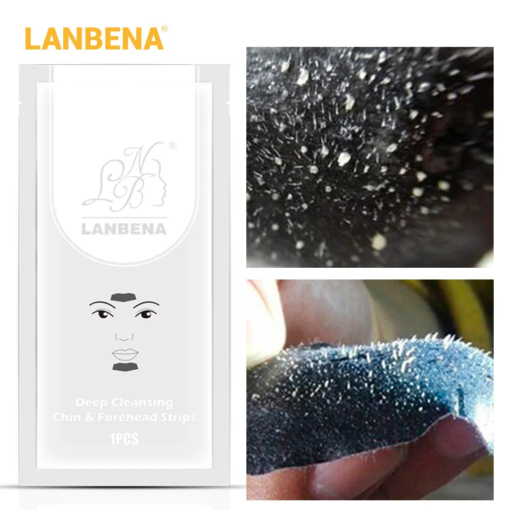 LANBENA, маска для удаления черных точек, Маска Для Носа+ подбородок, лоб, черная маска для головы, лечение акне, полоска пор, черная маска, пилинг, уход за кожей носа