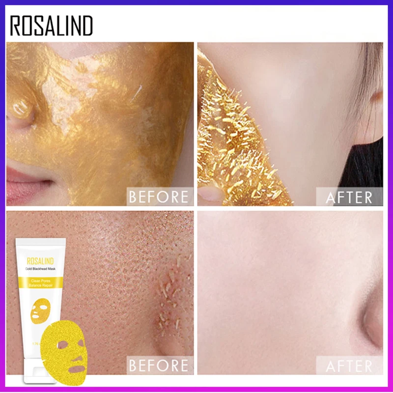 ROSALIND, 24 K, Золотая коллагеновая маска для пилинга лица, средство для удаления черных точек, Антивозрастные Усадочные поры, акне, уход за кожей, косметические маски для лица