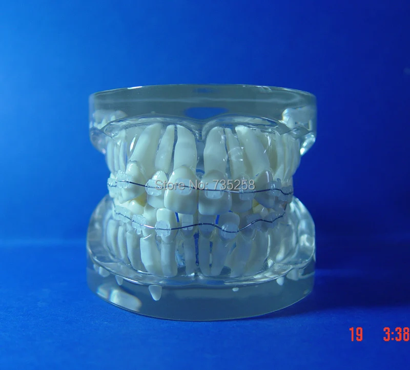 

Teeth Orthodontic Model,Ceramic Braces Wrong jaw Demonstration Model,Orthodontics Practice Model