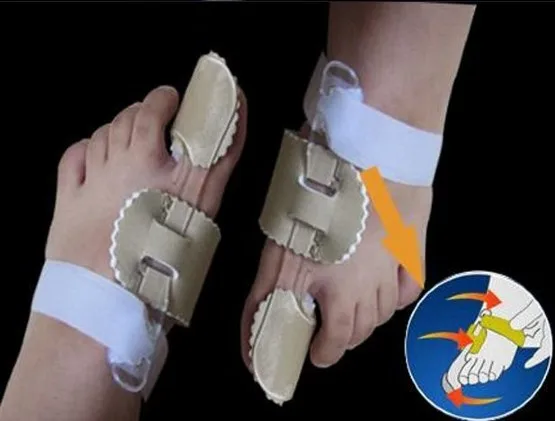 Goodnight Bunion регламентирует узкие участки регулируемые аналогично средству по