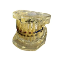1 pcs dental standard teeth transparent model teach study dentistry material dentist tools dental lab material