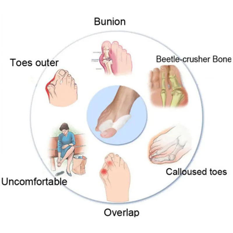 

2PCS/Pair Feet Care Silicone Gel Bunion Protector Toe Straightener Separator Alignment Pain Relief Thumb Corrector Orthotics
