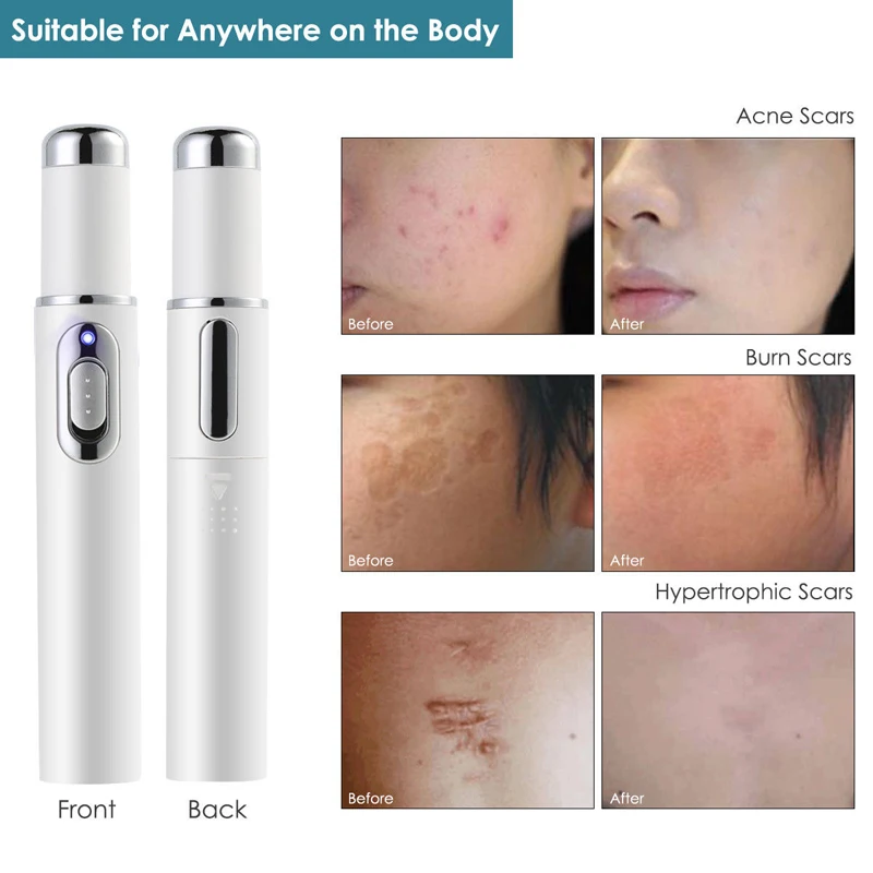 Медицинское электронное устройство для лазерной терапии сисветильник - купить