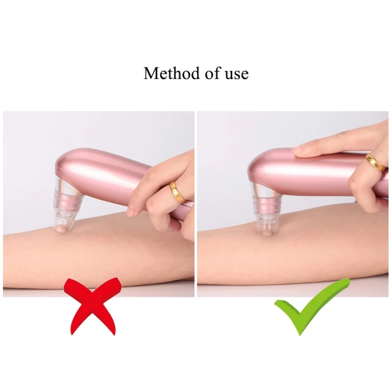 Новинка 2019 очищающая косметологическая машина для лица уход за кожей пор