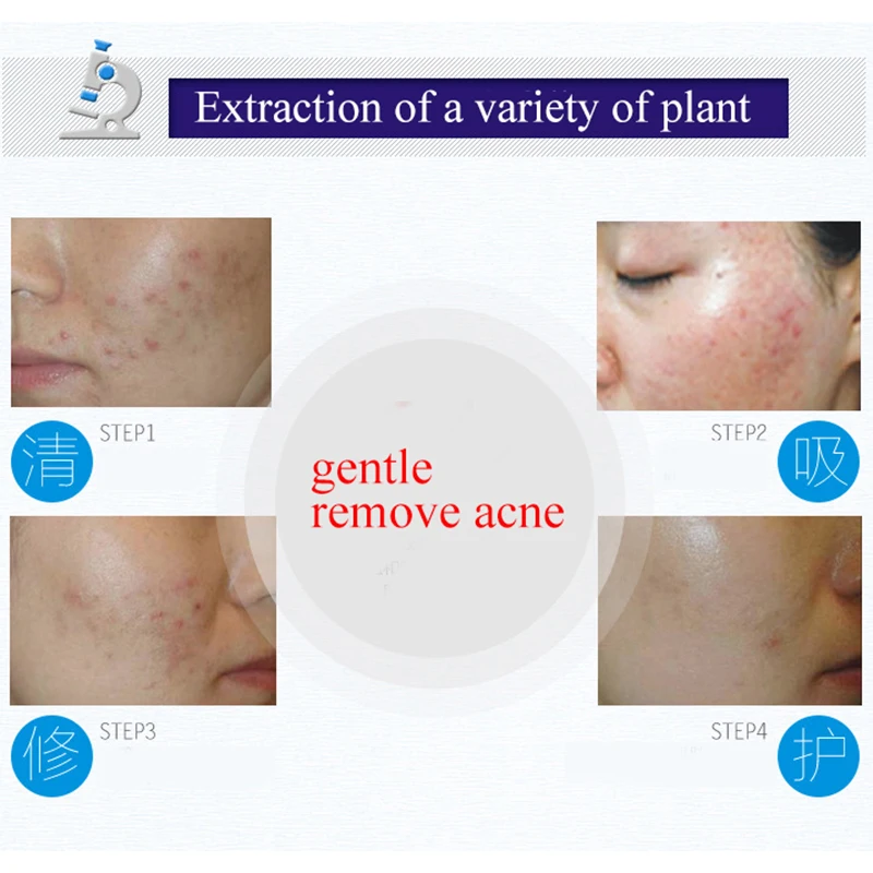 BIOAQUA питательные увлажняющие по уходу за кожей лечение акне избавление от прыщей