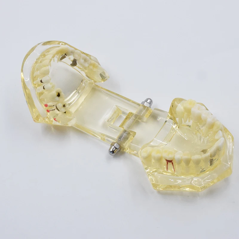 Флейты для реставрации имплантов синие прозрачные розовые желтые 4 цвета