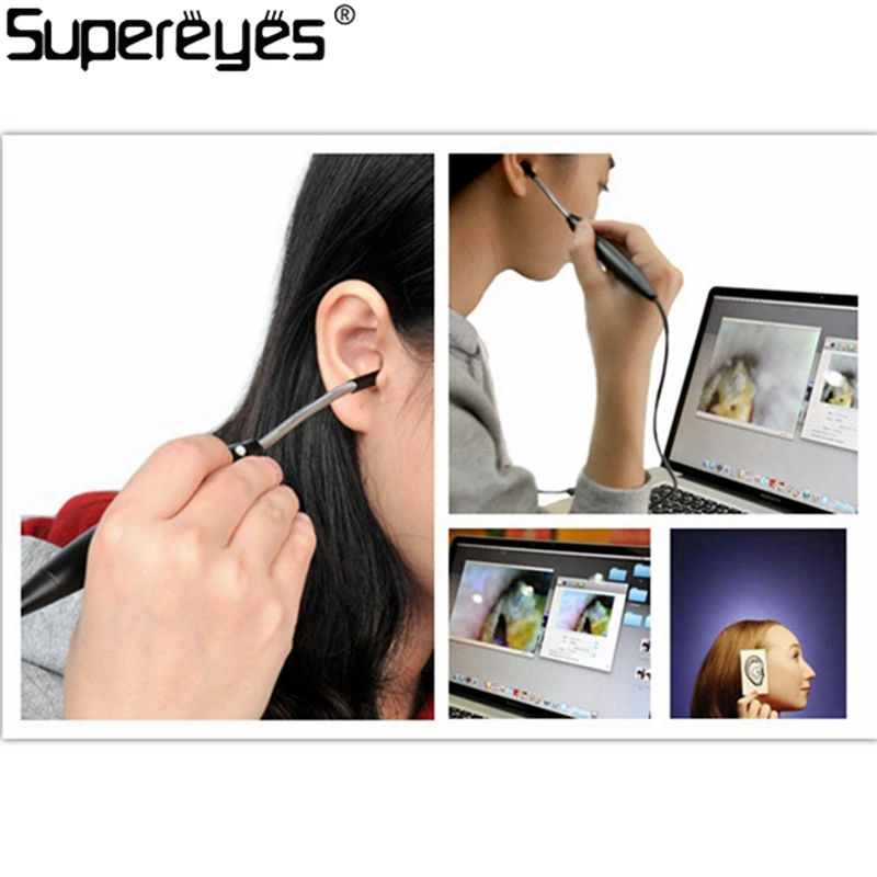 Эндоскоп для ушей Supereyes камера 100X5 мм отоскоп портативный водонепроницаемый