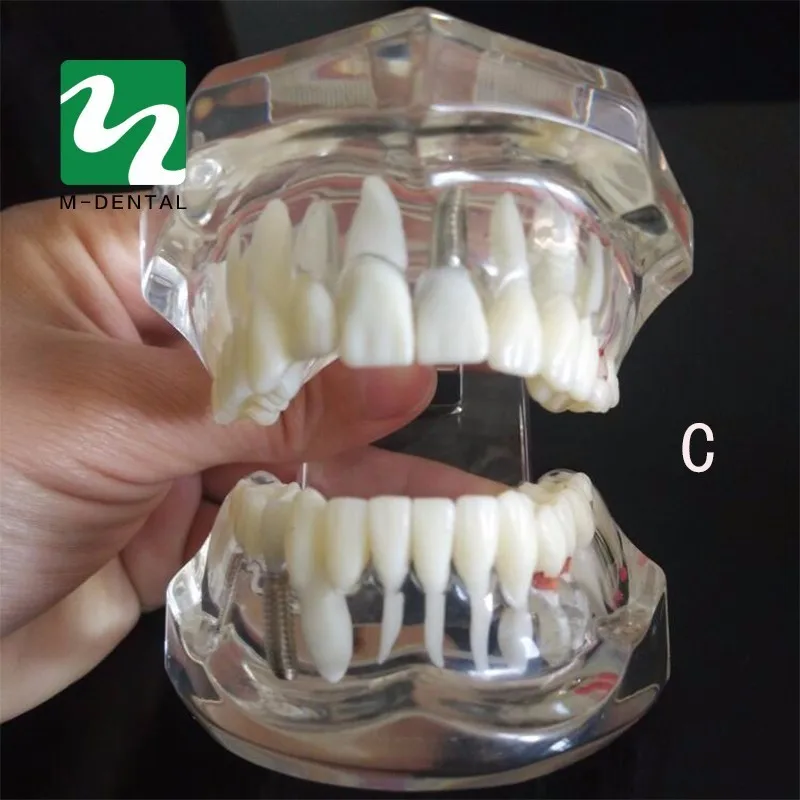 Различные стоматологические модели зубов используются для обучения и