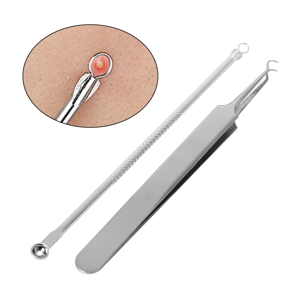 2 шт./компл. новая мода Женский изогнутый инструмент для удаления угрей прыщей