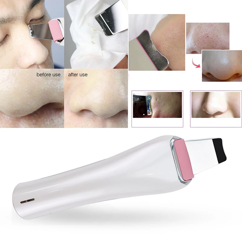 Ультразвуковой скребок для кожи приспособления очищения лица удаление черных