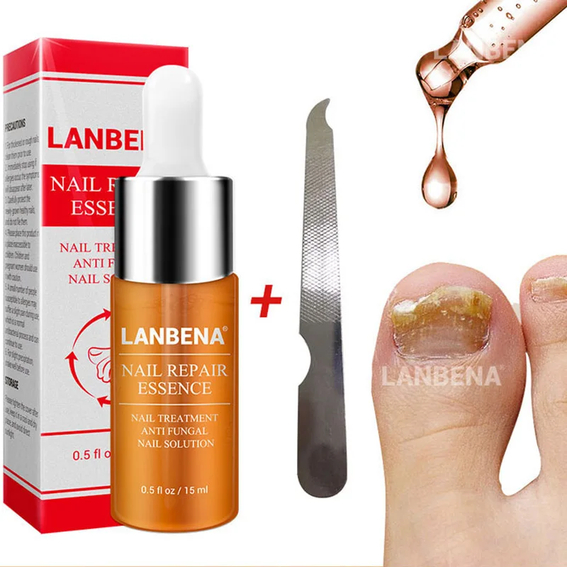 LANBENA пилка для ногтей эссенция удаления прополиса гидрогенизированный