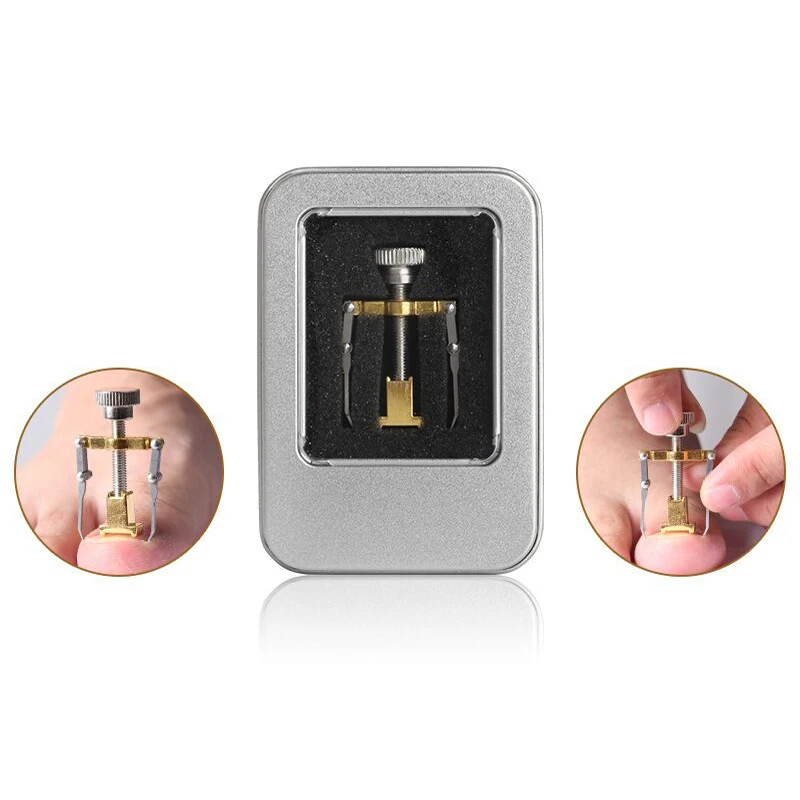 Вросший носок 1 шт. инструмент для восстановления ногтей педикюр закрепитель на