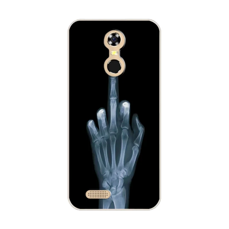 W09 Бампер для телефона для Coque Oukitel C8, чехол для Fundas Oukitel C8 C 8 5,", мягкий силиконовый чехол из ТПУ с узором в виде сердца - Цвет: W09