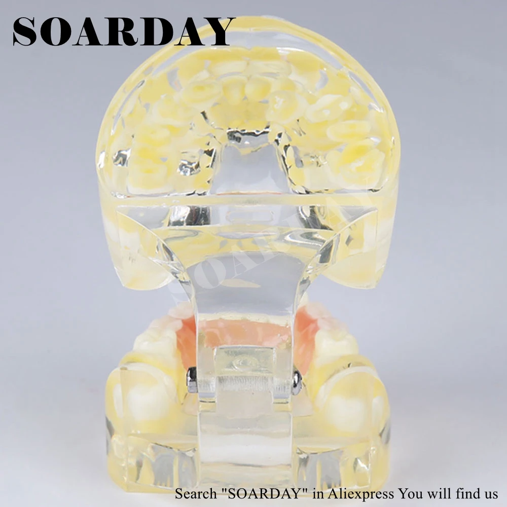 

SOARDAY Child Primary Teeth Retainer Model Dentist Teaching Model Dental Materials Primary Teeth Premature Loss