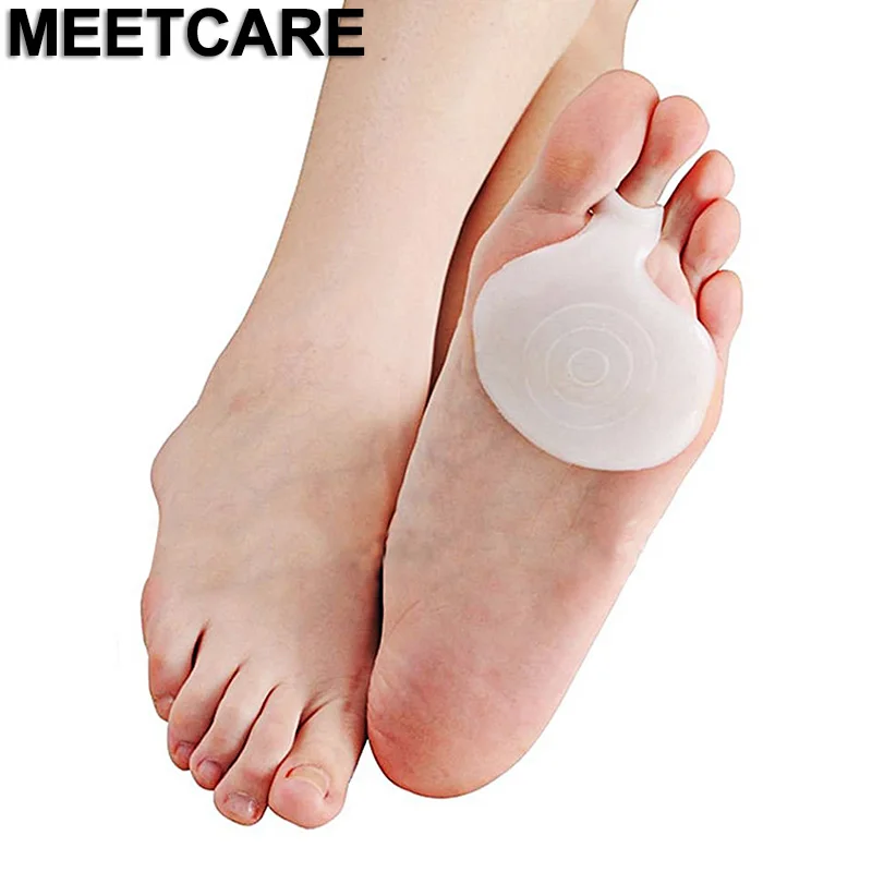Фиксатор для обуви на высоком каблуке в форме яблока или груши|shoe brace|foot braceshoes for