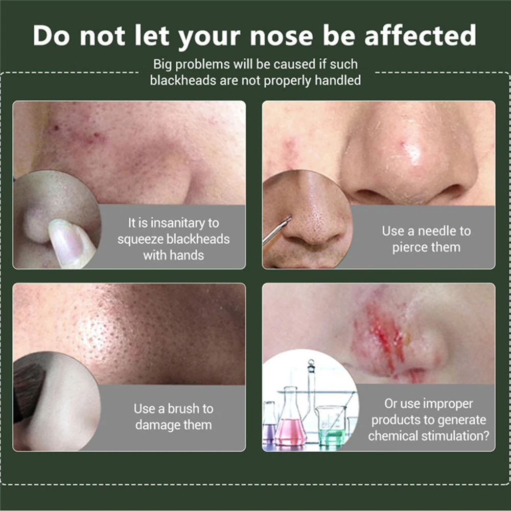 3 шт./компл. глубокие маски для удаления угрей лица очищающие отшелушивающие из