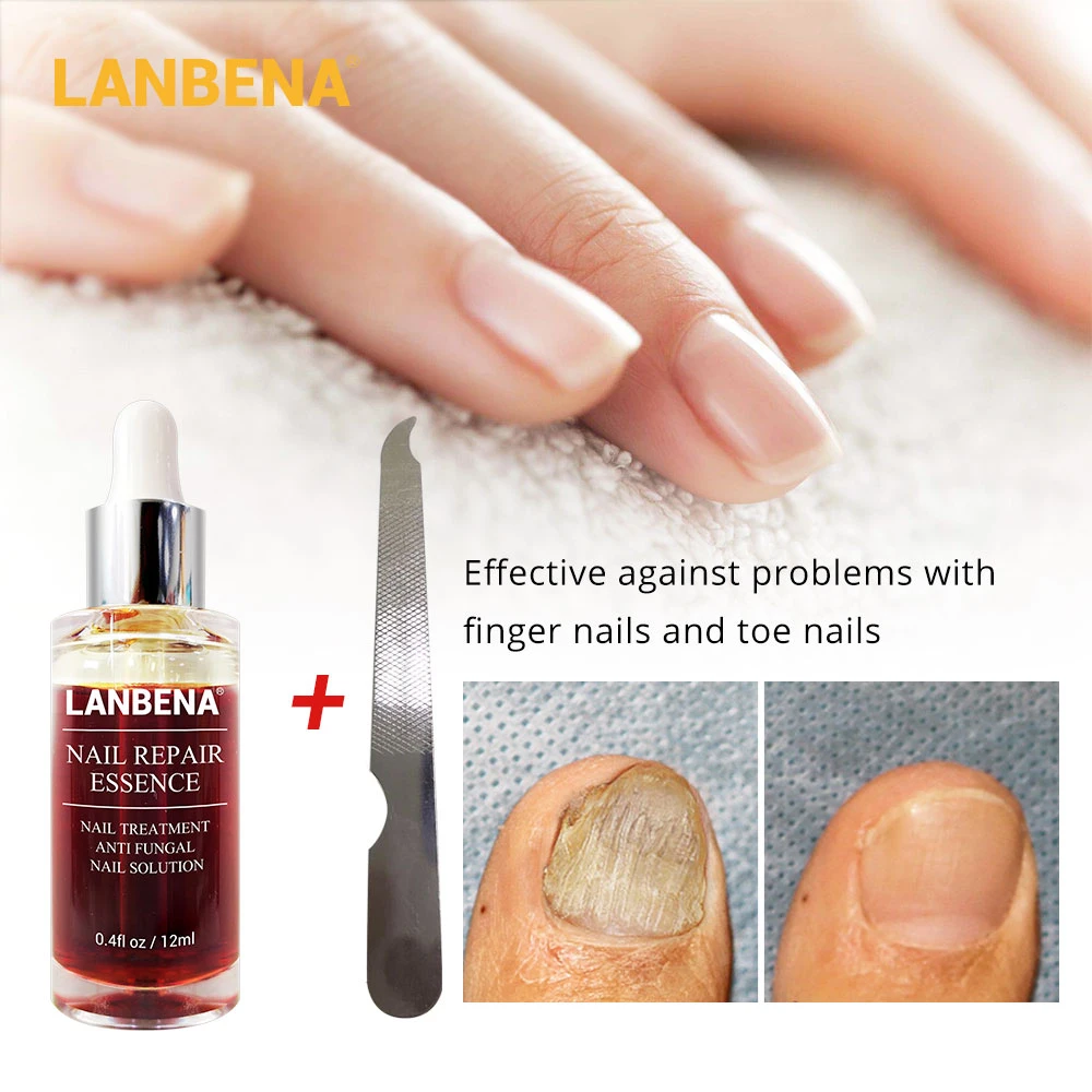 

LANBENA Nail Repair Essence Serum Fungal Nail Treatment Remove Onychomycosis Toe Nail Nourishing Brightening Hand And Foot Care