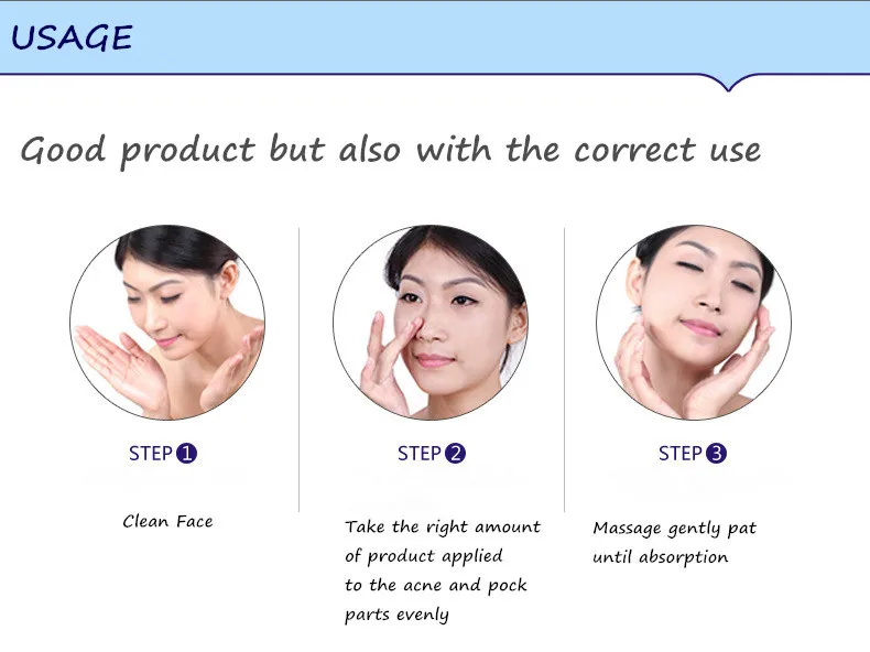 BIOAQUA марки Acne крем анти-акне удаления отбеливающий гель увлажняющий крем для лица 30 г масла Contorl уход за кожей